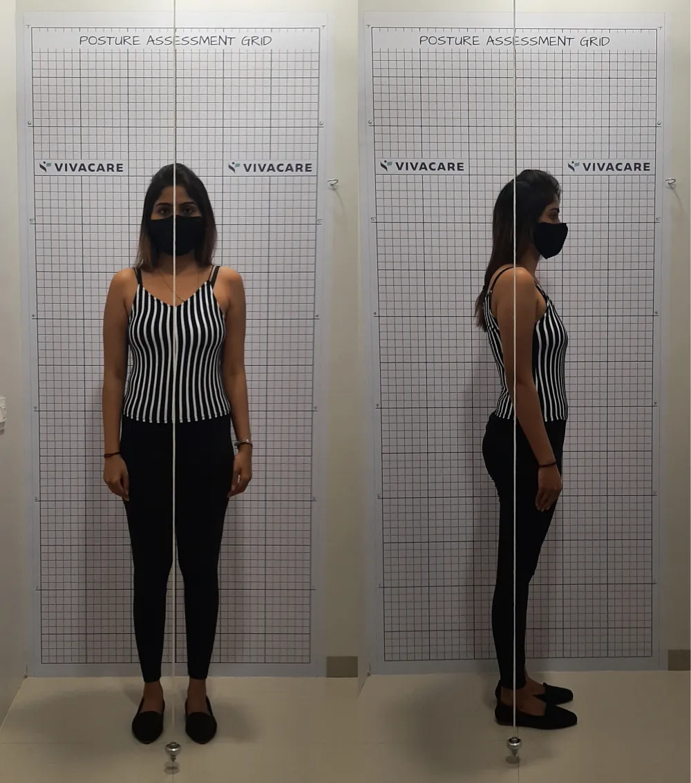 Posture Assessment & Correction is available at Vivacare Advanced Physiotherapy & Pain Clinic, Pune